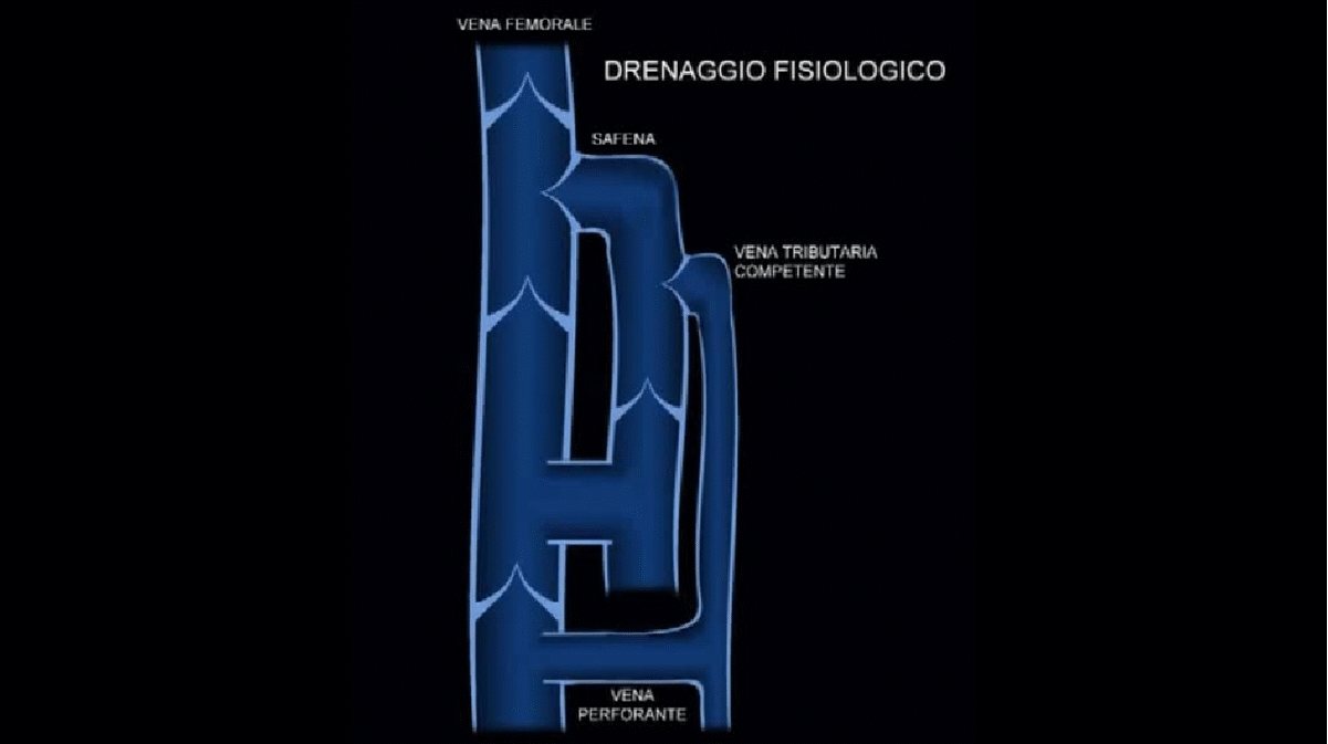 drenaggio-fisiologico