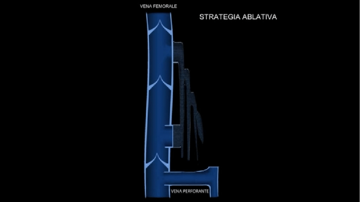 strategia-ablativa