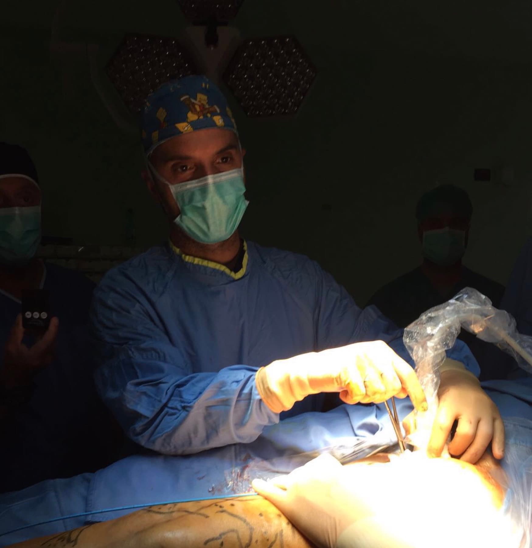 Chirurgia mini-invasiva con conservazione della safena